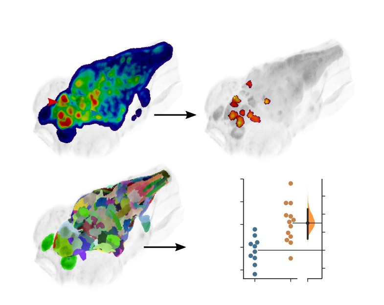 Morphometric analysis and neuroanatomical mapping of the zebrafish brain