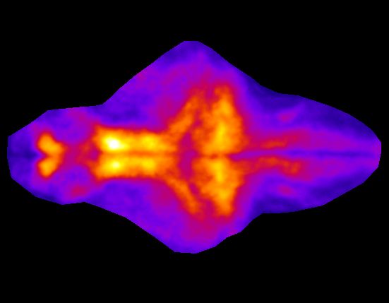 Elevated body temperature exacerbates arrhythmia and seizure-like activity in a zebrafish model of Timothy syndrome.